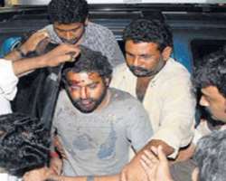 The actor survived a deadly car accident on  Indian National Highway-9 in March 2009. He also fractured his finger while working out and had to underg